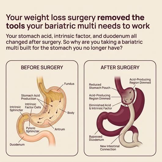 Advanced Post-Bariatric Nutritional Support